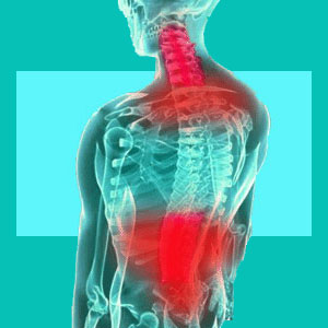 Alexander Technic for herniated discs