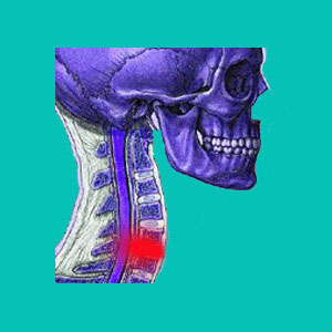 bulging disc treatments