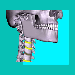 cervical degenerative disc disease causes