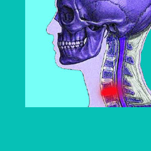 cervical herniated disc