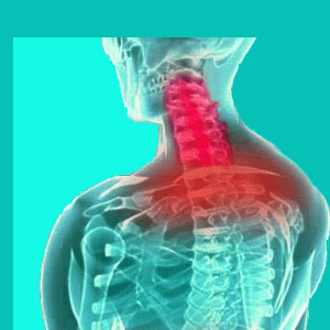 cervical herniated disc symptoms