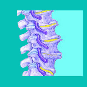 degenerative disc disease