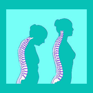 degenerative disc disease diagnosis