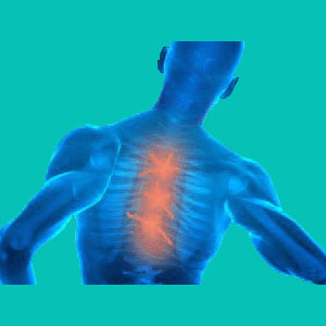 do herniated discs cause pain