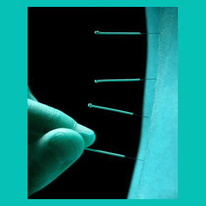 herniated disc acupuncture