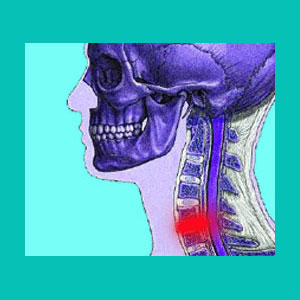 herniated disc c5 c6