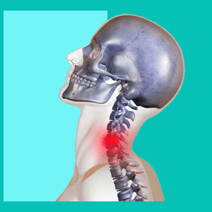 herniated disc in the neck