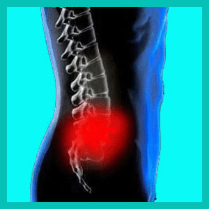 herniated disc injury