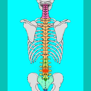 Herniated Disc L3-L4 - Herniated Disc