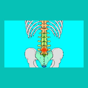 herniated disc l4 l5