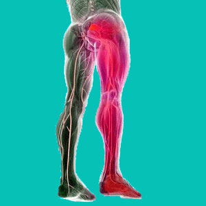 herniated disc leg pain