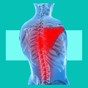 herniated disc muscle spasm