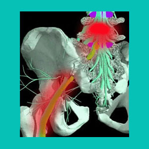 herniated disc nerve damage
