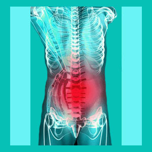 herniated disc recurrence