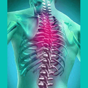 herniated disc upper back pain