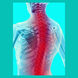 herniated discs and tension myositis syndrome