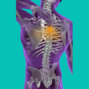 herniated disc solution