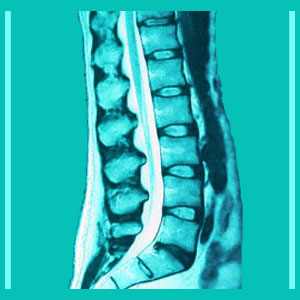 lumbar degenerative disc disease diagnosis