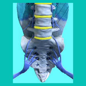 lumbar herniated disc causes