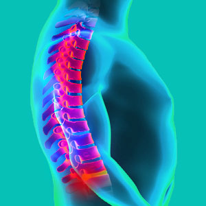 spinal disc reherniation