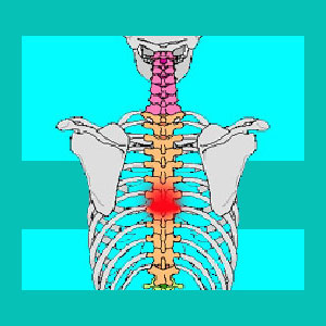 thoracic herniated disc