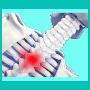 thoracic herniated disc causes