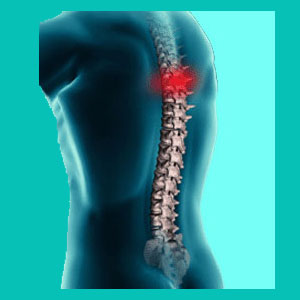 thoracic herniated disc diagnosis