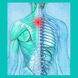 thoracic herniated disc injury