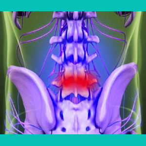 unexplained herniated disc